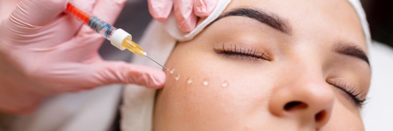 Bioestimulador de colágeno sendo injetado na pele de uma mulher, promovendo a bioestimulação de colágeno para um efeito lifting